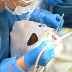 Лечение зубных каналов под микроскопом: золотой стандарт эндодонтии