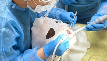 Лечение зубных каналов под микроскопом: золотой стандарт эндодонтии