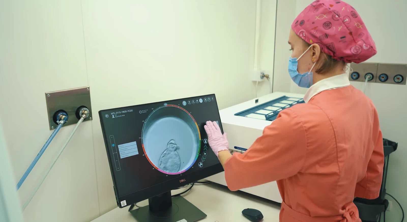 Внутрішньоматкова інсемінація: м'який крок до батьківства, що єднає науку та природу