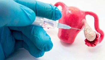 Жіноче безпліддя та донорство яйцеклітин