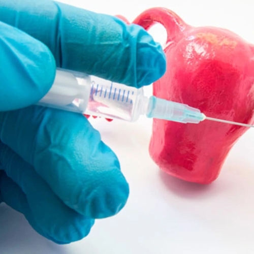 Жіноче безпліддя та донорство яйцеклітин