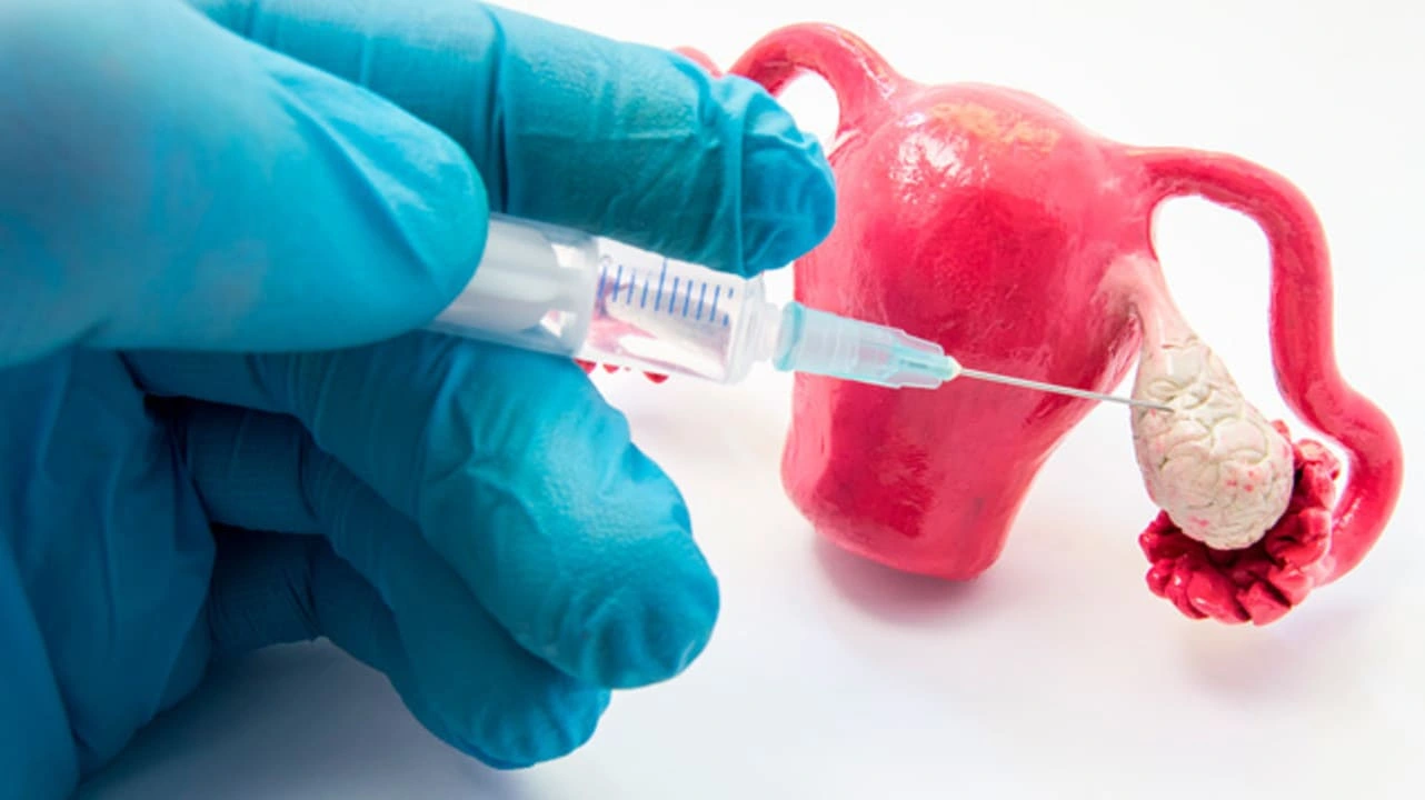 Жіноче безпліддя та донорство яйцеклітин