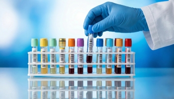 Когда цифры рассказывают про здоровье больше, чем самочувствие: зачем нужен биохимический анализ крови