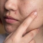 Як позбутися сірої тьмяної шкіри без агресивних пілінгів