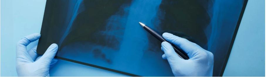 Перелом хребта: ступені тяжкості, лікування та реабілітація